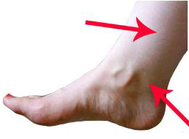 Ankle Point